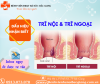 Biểu hiện và dấu hiệu nhận biết của Trĩ nội – Trĩ ngoại