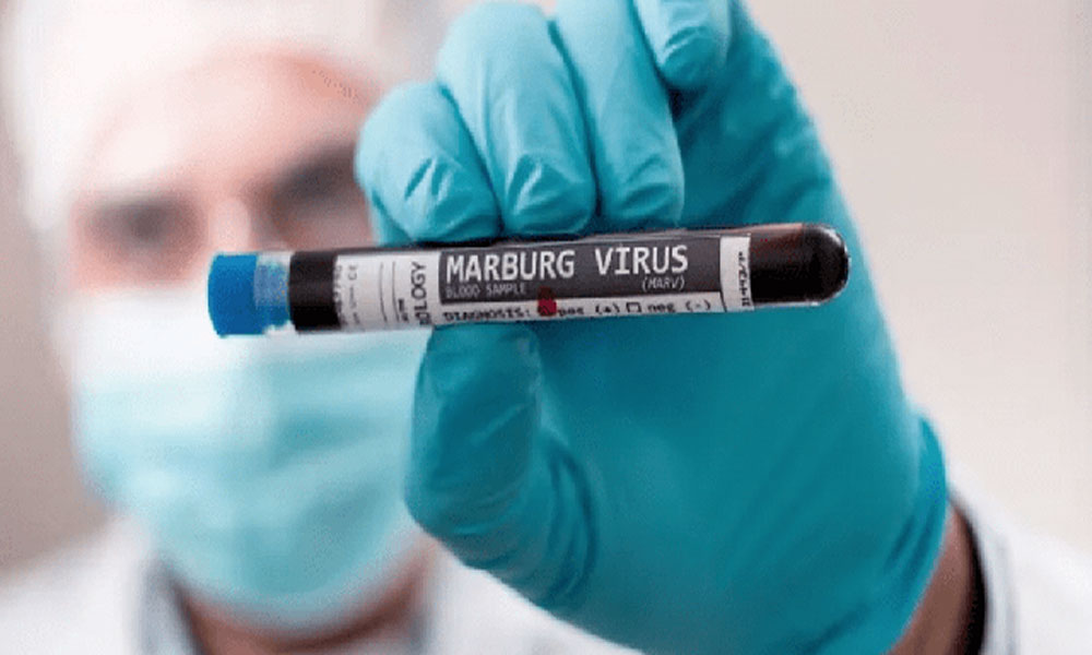 Virus Marburg có thể lây từ người sang người