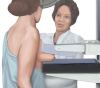 Lợi ích của chụp X quang tuyến vú (mammography)
