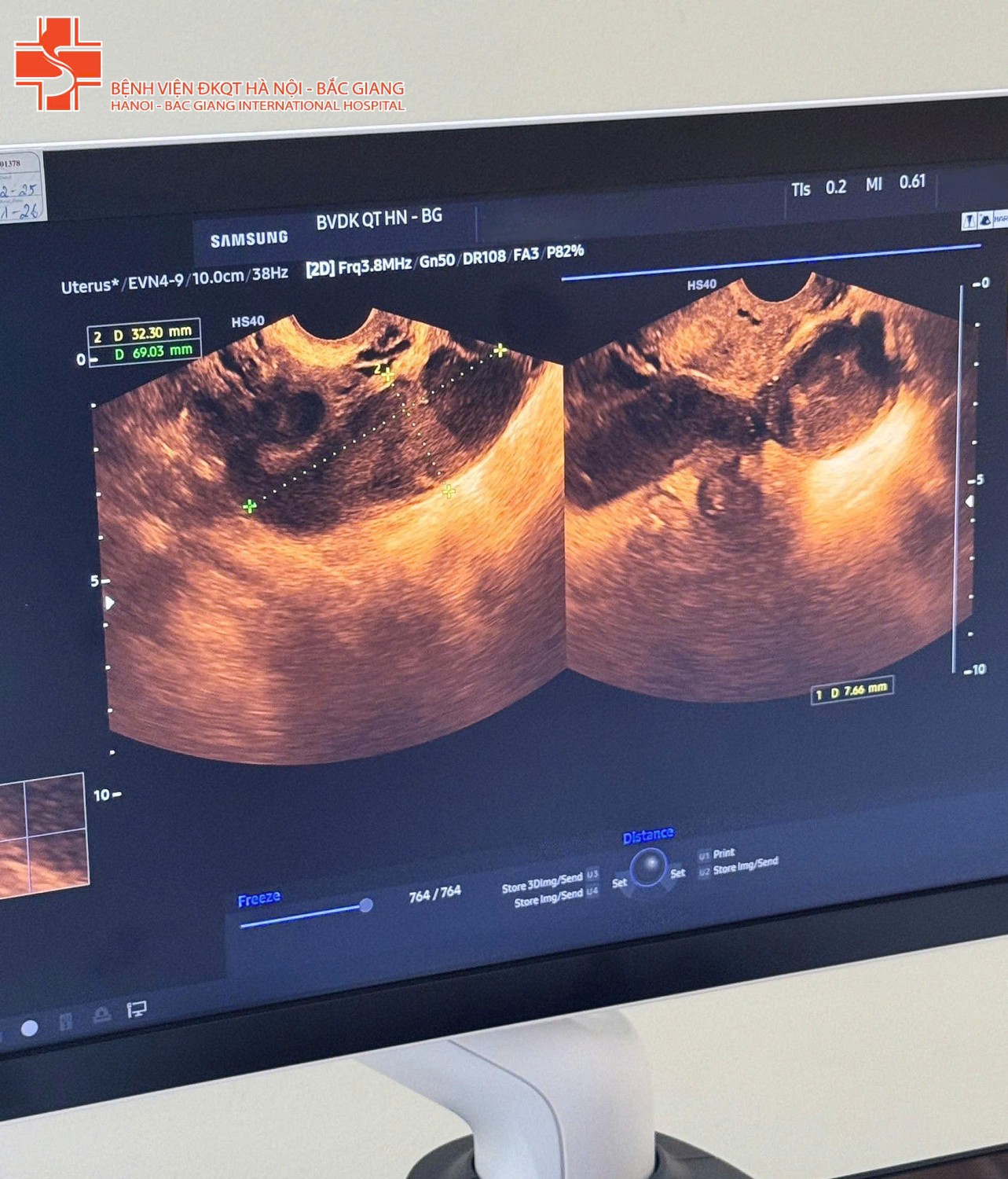 669557642 1568791191918698 3019293918298162027 n